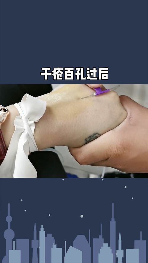 千疮百孔,《千疮百孔》百度云无删减完整版在线观看，艾什莉·贾德主演的